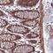 DIS3 Homolog, Exosome Endoribonuclease And 3'-5' Exoribonuclease antibody, PA5-58723, Invitrogen Antibodies, Immunohistochemistry paraffin image 