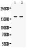 Integrin Subunit Alpha L antibody, PA5-79531, Invitrogen Antibodies, Western Blot image 