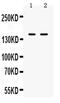 Integrin Subunit Alpha L antibody, PA5-79531, Invitrogen Antibodies, Western Blot image 