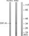 Casein Kinase 1 Alpha 1 antibody, GTX87999, GeneTex, Western Blot image 