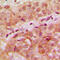 WD Repeat And HMG-Box DNA Binding Protein 1 antibody, GTX55930, GeneTex, Immunohistochemistry paraffin image 