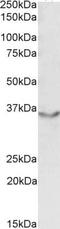 Junctional Adhesion Molecule 2 antibody, PA5-19160, Invitrogen Antibodies, Western Blot image 