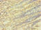 Protein Interacting With PRKCA 1 antibody, LS-C285648, Lifespan Biosciences, Immunohistochemistry paraffin image 