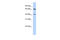 RB Binding Protein 5, Histone Lysine Methyltransferase Complex Subunit antibody, 25-189, ProSci, Enzyme Linked Immunosorbent Assay image 