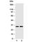 Protein SSX2 antibody, R30337, NSJ Bioreagents, Western Blot image 