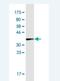 Collagen Type I Alpha 2 Chain antibody, H00001278-M03, Novus Biologicals, Western Blot image 