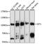 GIT ArfGAP 1 antibody, A15437, ABclonal Technology, Western Blot image 