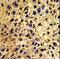 Nucleoporin 62 antibody, LS-C163078, Lifespan Biosciences, Immunohistochemistry paraffin image 