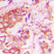 Insulin Receptor antibody, LS-C358785, Lifespan Biosciences, Immunohistochemistry paraffin image 