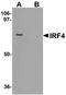 Interferon Regulatory Factor 4 antibody, orb95662, Biorbyt, Western Blot image 