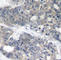Ribosomal Protein S6 Kinase B1 antibody, AP0449, ABclonal Technology, Immunohistochemistry paraffin image 
