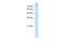 SLC20A2 antibody, A02806, Boster Biological Technology, Western Blot image 