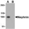 NPHS1 Adhesion Molecule, Nephrin antibody, MBS151503, MyBioSource, Western Blot image 