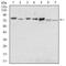 Syndecan 1 antibody, GTX00451, GeneTex, Western Blot image 