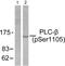 Phospholipase C Beta 3 antibody, PA5-38089, Invitrogen Antibodies, Western Blot image 