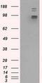 GRIP1 Associated Protein 1 antibody, MA5-25035, Invitrogen Antibodies, Western Blot image 