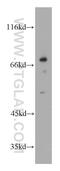 Vanin 1 antibody, 21745-1-AP, Proteintech Group, Western Blot image 
