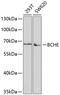Butyrylcholinesterase antibody, GTX30084, GeneTex, Western Blot image 
