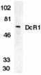 TNF Receptor Superfamily Member 10c antibody, GTX25975, GeneTex, Western Blot image 