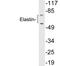 Elastin antibody, LS-C199841, Lifespan Biosciences, Western Blot image 