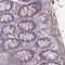 BEN Domain Containing 5 antibody, NBP2-31701, Novus Biologicals, Immunohistochemistry paraffin image 