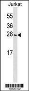 CGG Triplet Repeat Binding Protein 1 antibody, 59-888, ProSci, Western Blot image 