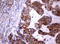 Phosphatidylinositol-4-Phosphate 3-Kinase Catalytic Subunit Type 2 Alpha antibody, LS-C336385, Lifespan Biosciences, Immunohistochemistry paraffin image 