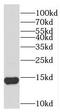 Testis Expressed 12 antibody, FNab08607, FineTest, Western Blot image 