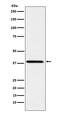 SUMO1 Activating Enzyme Subunit 1 antibody, M04753-2, Boster Biological Technology, Western Blot image 