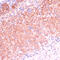 Cytochrome P450 Family 11 Subfamily B Member 2 antibody, 15-536, ProSci, Immunohistochemistry paraffin image 