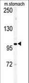 Ephrin type-A receptor 6 antibody, LS-C100266, Lifespan Biosciences, Western Blot image 