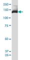 Phosphoinositide-3-Kinase Regulatory Subunit 4 antibody, H00030849-M02, Novus Biologicals, Western Blot image 