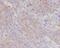 Actin Alpha 2, Smooth Muscle antibody, M01072-3, Boster Biological Technology, Immunohistochemistry frozen image 