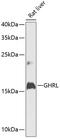 Ghrelin And Obestatin Prepropeptide antibody, 14-523, ProSci, Western Blot image 