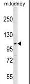 Signal Transducer And Activator Of Transcription 2 antibody, LS-C158265, Lifespan Biosciences, Western Blot image 