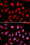 Enhancer Of Zeste 2 Polycomb Repressive Complex 2 Subunit antibody, STJ28310, St John