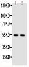 Nuclear Factor Kappa B Subunit 2 antibody, PA1946-1, Boster Biological Technology, Western Blot image 