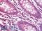 Ribosomal Protein L5 antibody, LS-C211204, Lifespan Biosciences, Immunohistochemistry paraffin image 