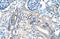 Mucin 1, Cell Surface Associated antibody, 29-577, ProSci, Immunohistochemistry paraffin image 