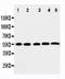 Cyclin Dependent Kinase 6 antibody, PA2125-1, Boster Biological Technology, Western Blot image 