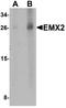 Empty Spiracles Homeobox 2 antibody, A04322-1, Boster Biological Technology, Western Blot image 