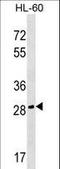 Cell Growth Regulator With EF-Hand Domain 1 antibody, LS-C159340, Lifespan Biosciences, Western Blot image 