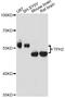 Tryptophan Hydroxylase 2 antibody, A14520, ABclonal Technology, Western Blot image 