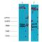 Insulin Degrading Enzyme antibody, LS-B14646, Lifespan Biosciences, Western Blot image 