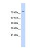 WW Domain Containing E3 Ubiquitin Protein Ligase 2 antibody, NBP1-53089, Novus Biologicals, Western Blot image 