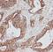Proteasome subunit beta type-7 antibody, FNab06876, FineTest, Immunohistochemistry paraffin image 