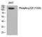 Catenin Delta 1 antibody, P02333, Boster Biological Technology, Western Blot image 