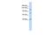 DExH-Box Helicase 30 antibody, GTX47513, GeneTex, Western Blot image 