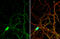 Protein Tyrosine Kinase 2 Beta antibody, GTX132447, GeneTex, Immunofluorescence image 
