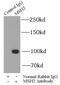 MutS Homolog 2 antibody, FNab05371, FineTest, Immunoprecipitation image 